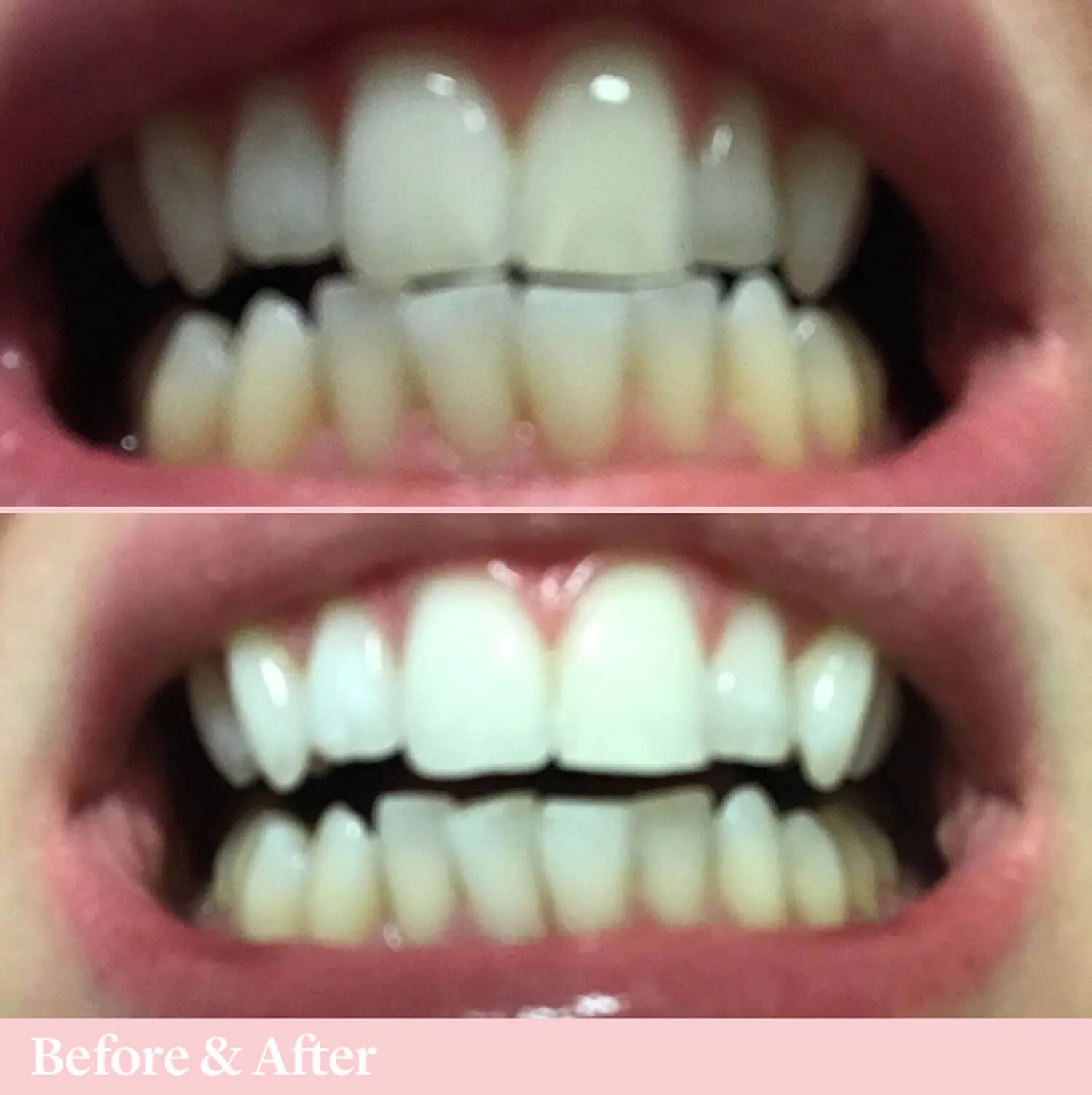 Oral Care Mouthwash for Decay 500ml