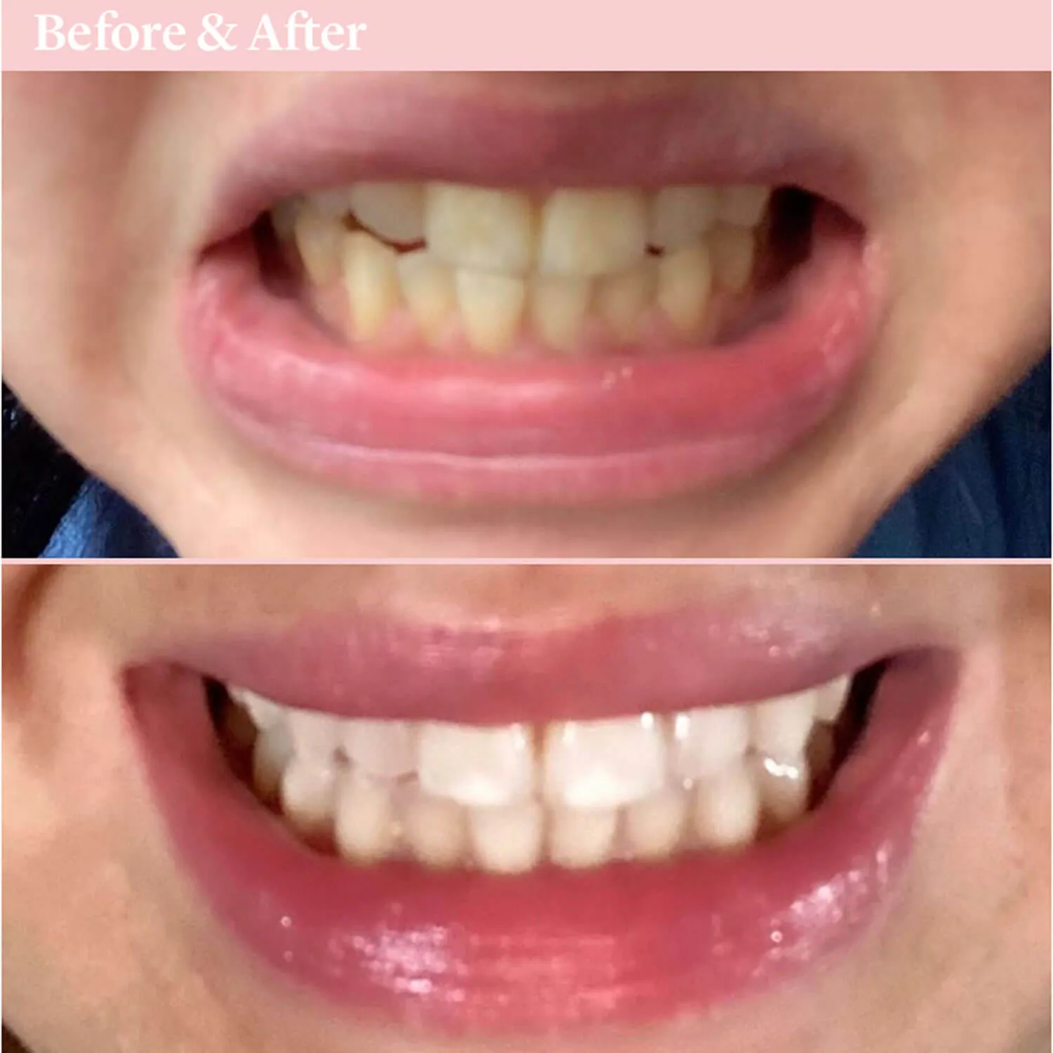 Oral Care Mouthwash for Decay 500ml